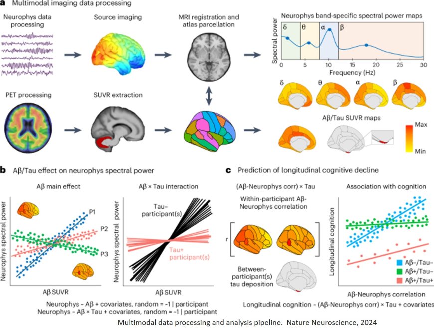 Understanding changes in pre-clinical Alzheimer’s disease