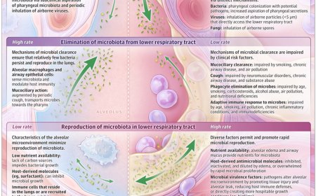 Community-Acquired Pneumonia