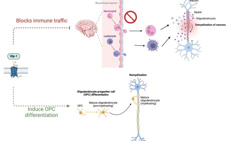 GLP-1 agonists and neurovascular diseases