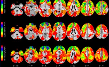 Common brain network detected among veterans with PTSD