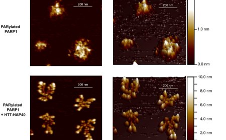 What hinders DNA repair in patients with Huntington’s Disease