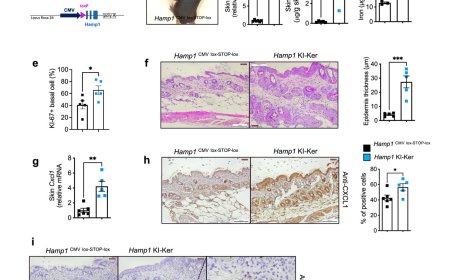 Skin hormone hepcidin in psoriasis