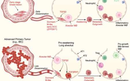 Special immune cells stop metastatic cancer
