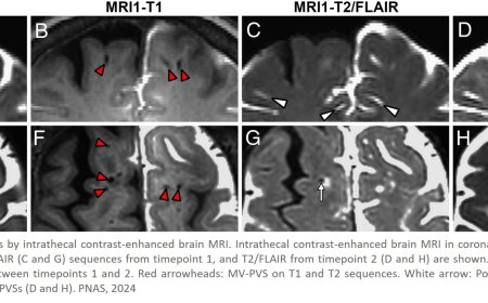 Brain’s waste-clearance pathways revealed for the first time
