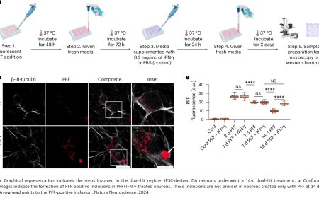 Modeling Parkinson’s disease pathology