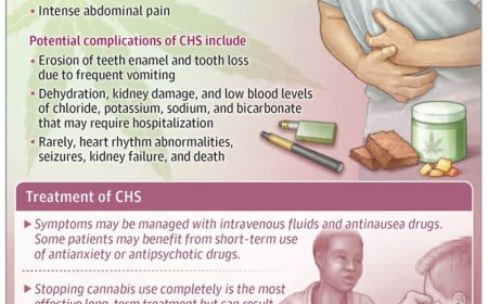 Cannabinoid Hyperemesis Syndrome