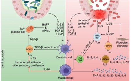 Ulcerative colitis