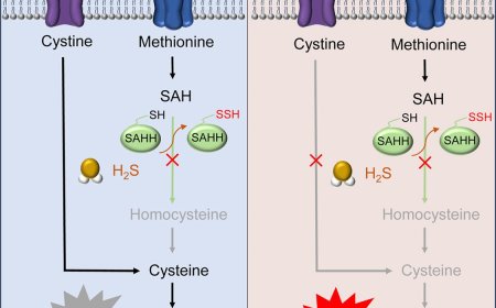 Hydrogen sulfide-mediated persulfidation and ferroptosis in non-small cell lung cancer