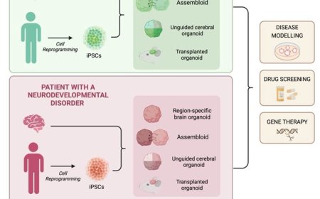 Evaluation of neurodevelopmental disorders using brain organoids