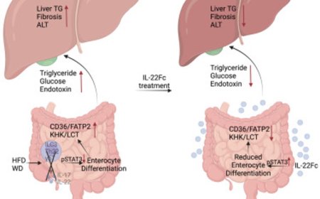 Exogenous IL-22 administration resolves MASLD