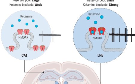 Brain region–specific action of ketamine