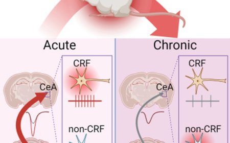 Amygdala neuroplasticity in the transition to chronic pain