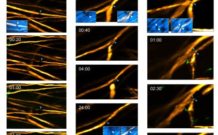 Microglia’s role in preventing axonal degeneration following spinal cord injury