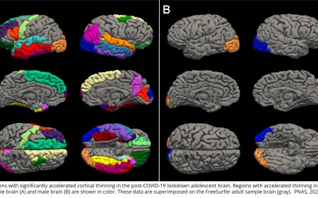 COVID-19 lockdowns prematurely aged teenage brains