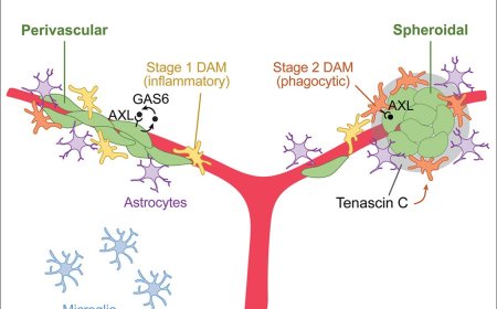 Initiation of breast cancer metastasis in the brain depends on tumor architectures and microenvironment