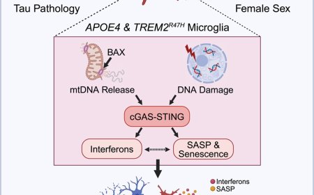 Alzheimer’s genetic risk factors spark inflammation in females