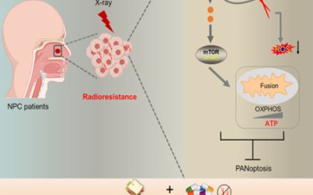How Fusobacterium nucleatum (Fn)-drives radioresistance in nasopharyngeal carcinoma