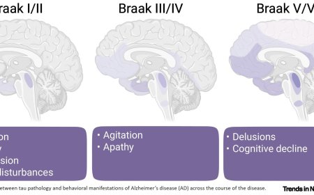 Monoaminergic systems and Alzheimer’s disease