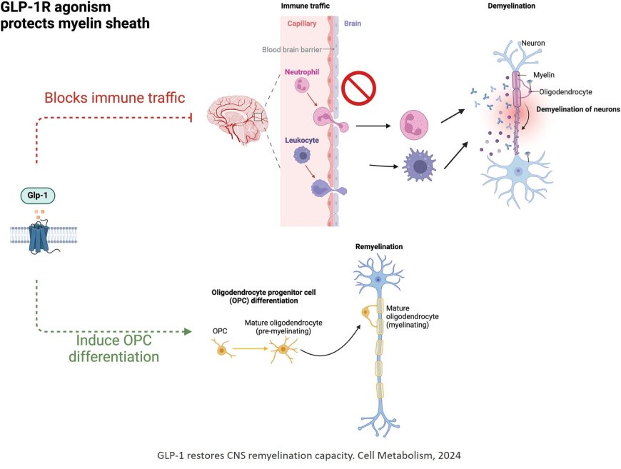 GLP-1 agonists and neurovascular diseases