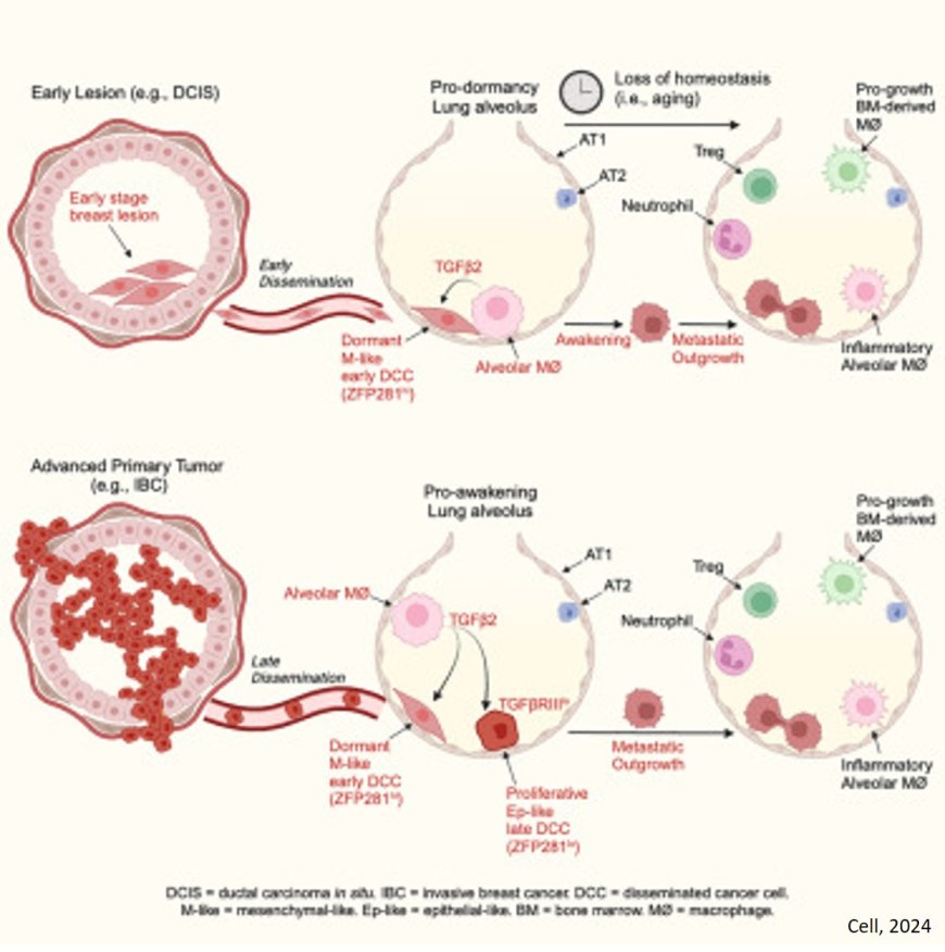 Special immune cells stop metastatic cancer