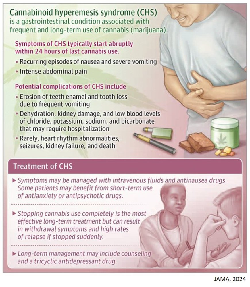 Cannabinoid Hyperemesis Syndrome