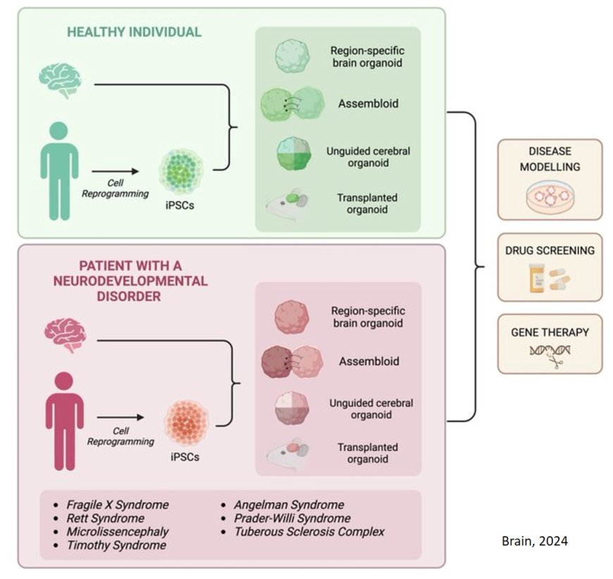 Deciphering the physiopathology of neurodevelopmental disorders using brain organoids