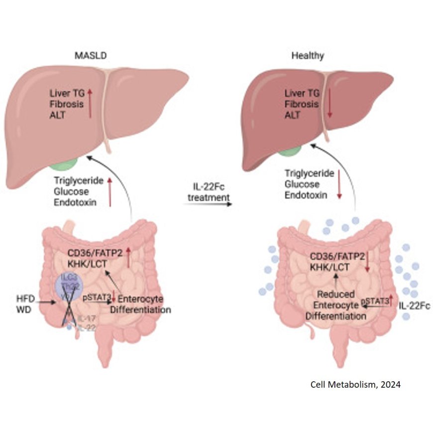 Exogenous IL-22 administration resolves MASLD