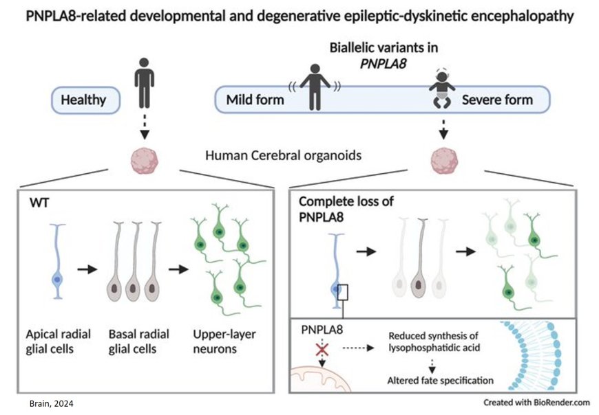 Biallelic null variants in PNPLA8 cause microcephaly!