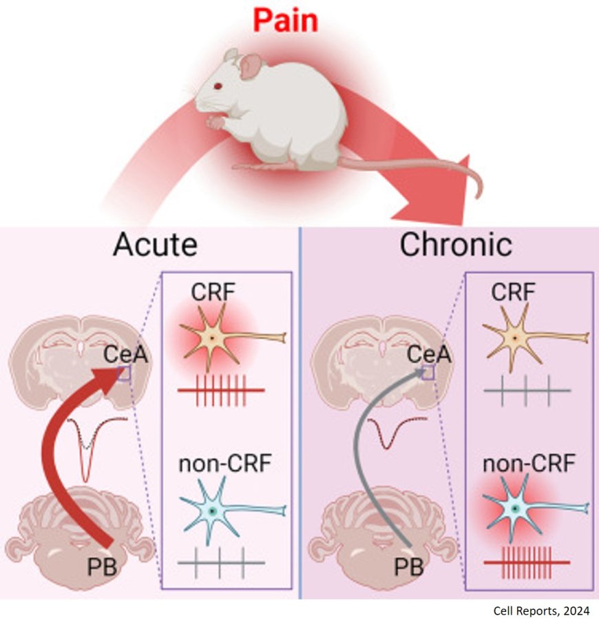 Cells and circuits for amygdala neuroplasticity in the transition to chronic pain