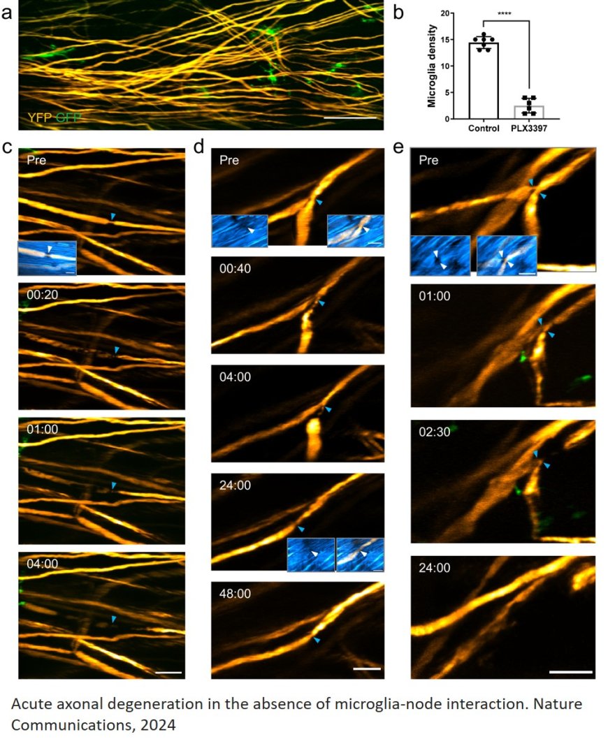 Microglia’s role in preventing axonal degeneration following spinal cord injury