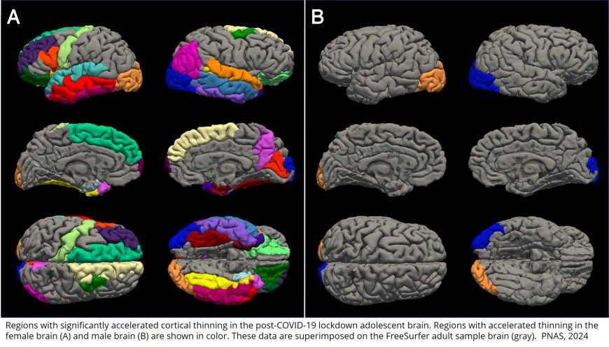 COVID-19 lockdowns prematurely aged teenage brains