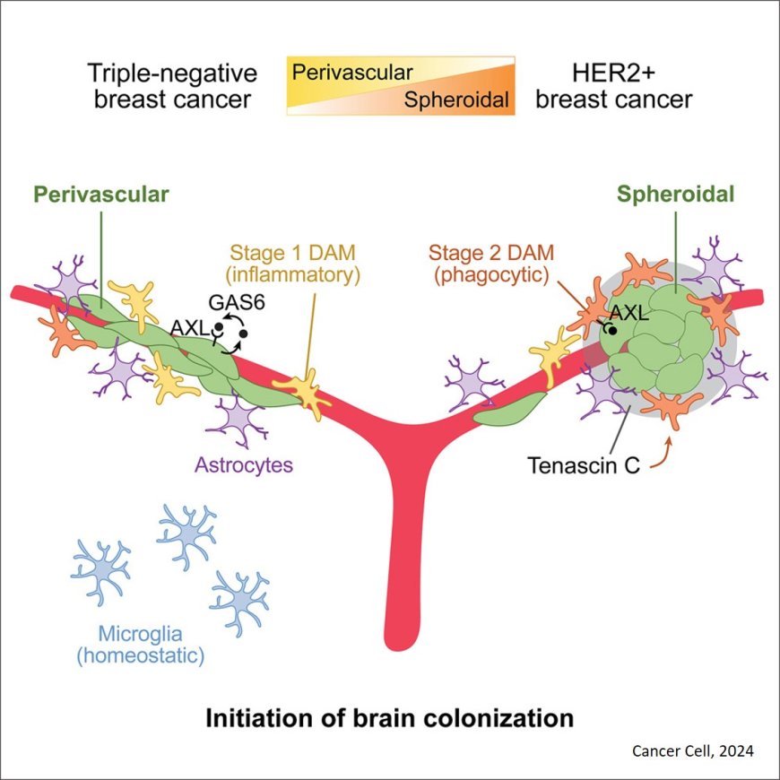 Distinct tumor architectures and microenvironments for the initiation of breast cancer metastasis in the brain