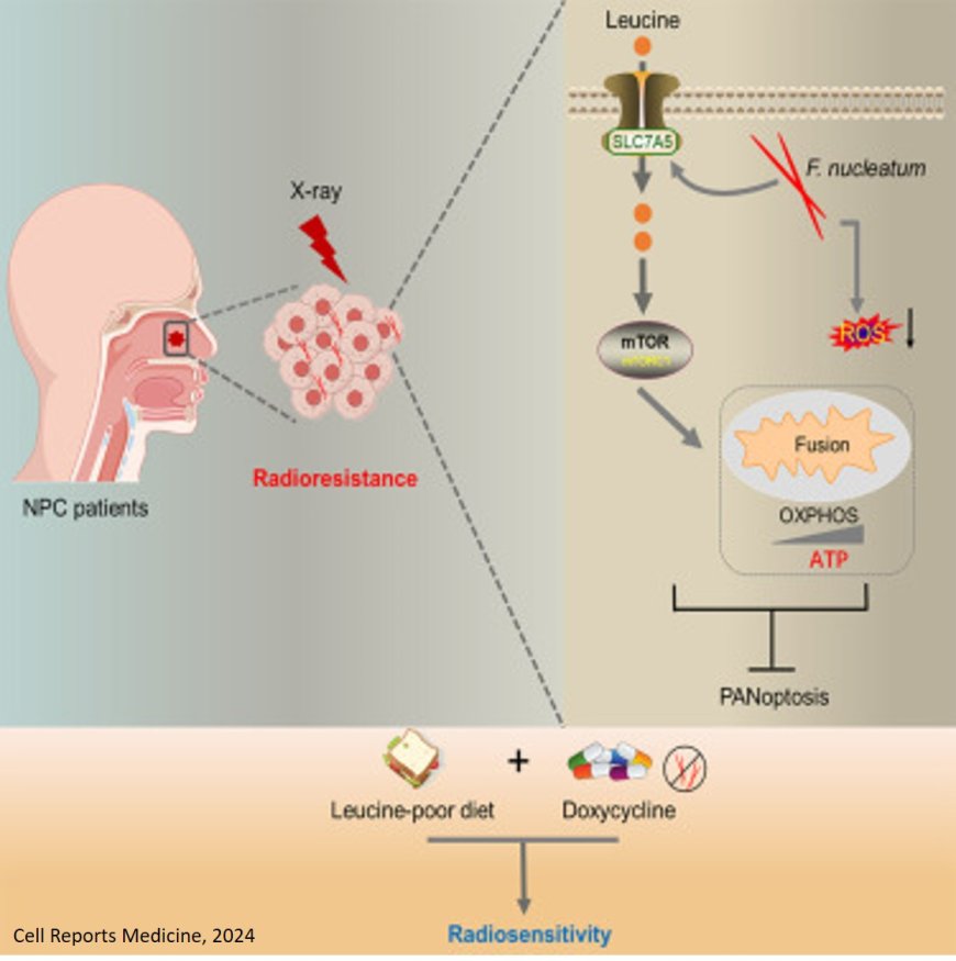 How Fusobacterium nucleatum (Fn)-drives radioresistance in nasopharyngeal carcinoma