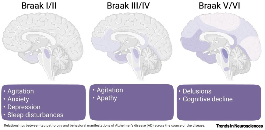 Monoaminergic systems and Alzheimer’s disease