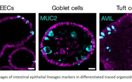 Regenerative stem cells in the human intestine identified!