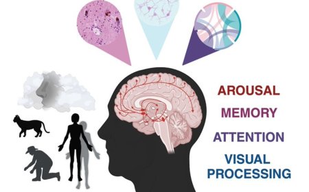 Visual hallucinations in Parkinson's disease: spotlight on 3 central cholinergic dysfunction