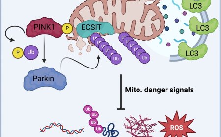 Roles of ECSIT in immunity and tumorigenesis