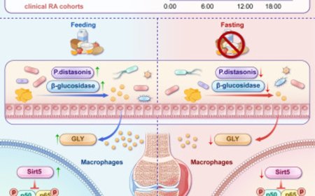 Modulating inflammatory rhythms in rheumatoid arthritis via dietary timimg