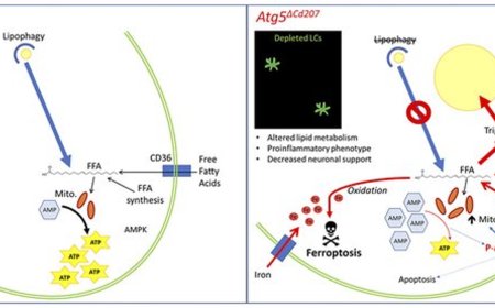 Epidermal maintenance of Langerhans cells relies on autophagy-regulated lipid metabolism