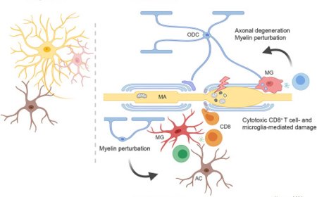 How brain function impacted by white matter aging