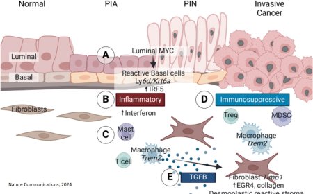 Convergent alterations in the tumor microenvironment of MYC-driven human and murine prostate cancer