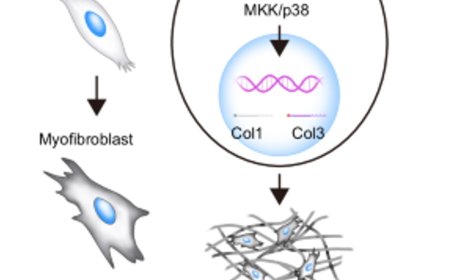 Protein kinase N promotes cardiac fibrosis in heart failure