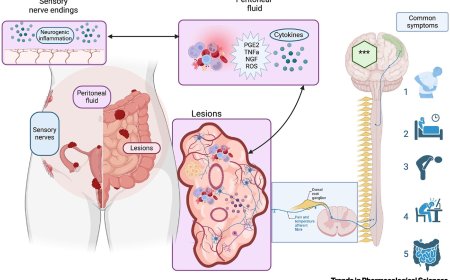 Cannabidiol therapy for symptom relief in endometriosis