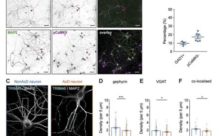 The cell biology of hippocampal neurons with dendritic axon origin