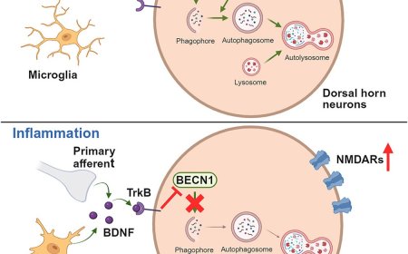 Pain hypersensitivity is dependent on autophagy protein Beclin 1 in males but not females
