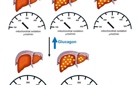 Glucagon promotes increased hepatic mitochondrial oxidation in humans with fatty liver disease