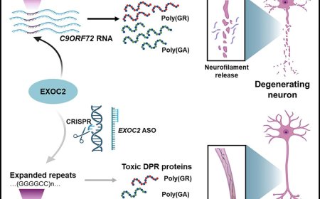 Exocytosis subunit regulates the toxicity in ALS