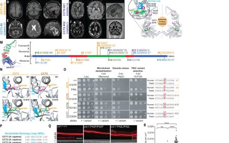Impaired chaperonin function may cause brain malformations and seizures