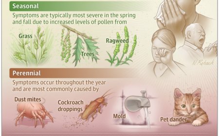 What Is Allergic Rhinitis?