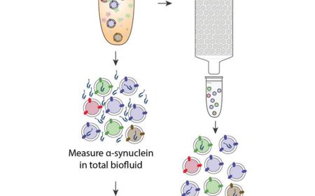 Measurement of α-synuclein in plasma extracellular vesicles